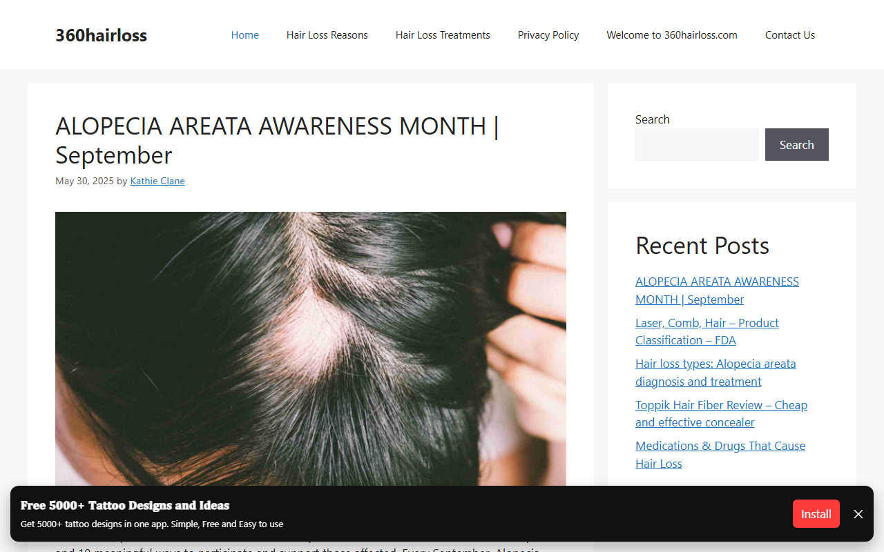 360hairloss.com screenshot